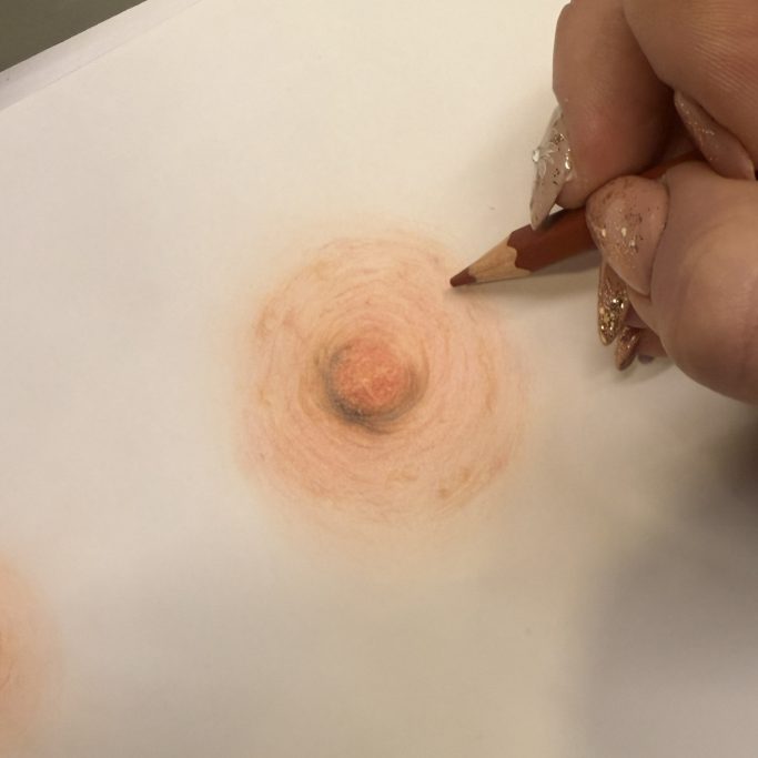 Brustwarzenrekonstruktion Beispiele