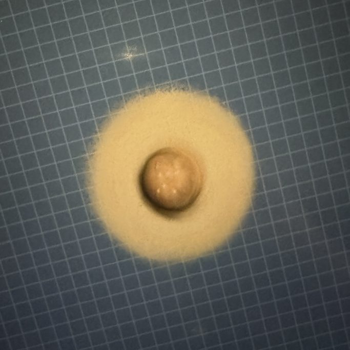 Brustwarzenrekonstruktion Beispiele